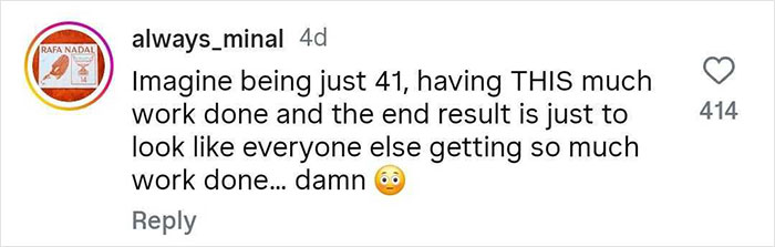 Comment expressing surprise about someone having many cosmetic procedures done by age 41, questioning the uniqueness of the results.
