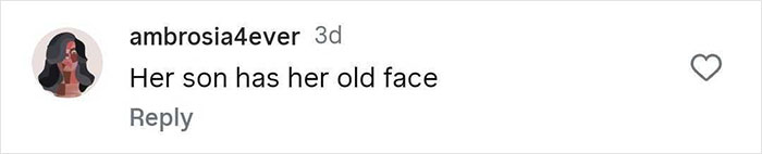 Screenshot of a social media comment mentioning facial appearance related to cosmetic procedures.