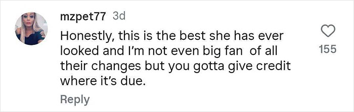 Screenshot of a social media comment praising Khlo&eacute; Kardashian's appearance amid cosmetic procedures discussion.