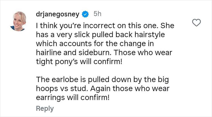 Comment discussing hairstyle and earlobe changes related to cosmetic procedures on Khlo&eacute; Kardashian.