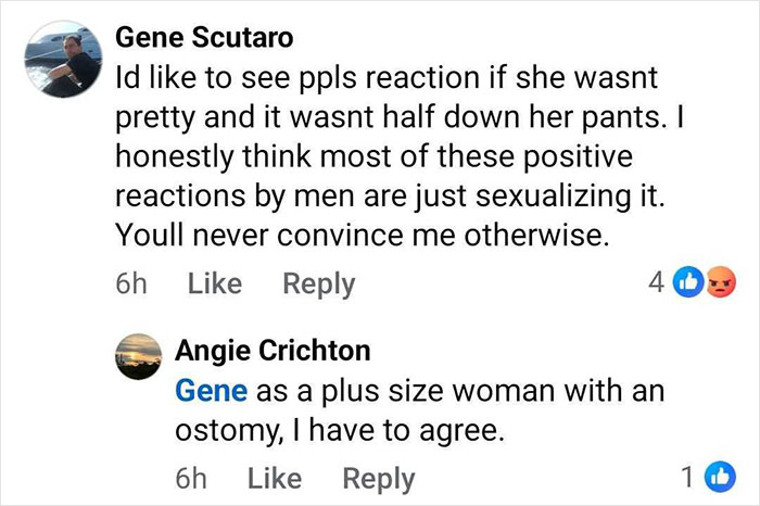 Screenshot of a social media comment conversation discussing reactions toward a woman with an ostomy bag.