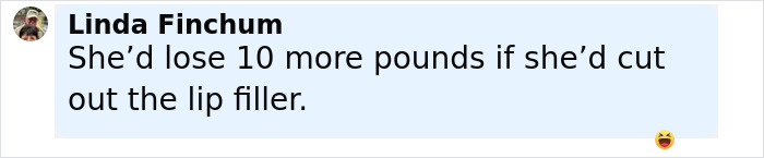 Screenshot of a social media comment by Linda Finchum discussing weight loss and lip filler effects.