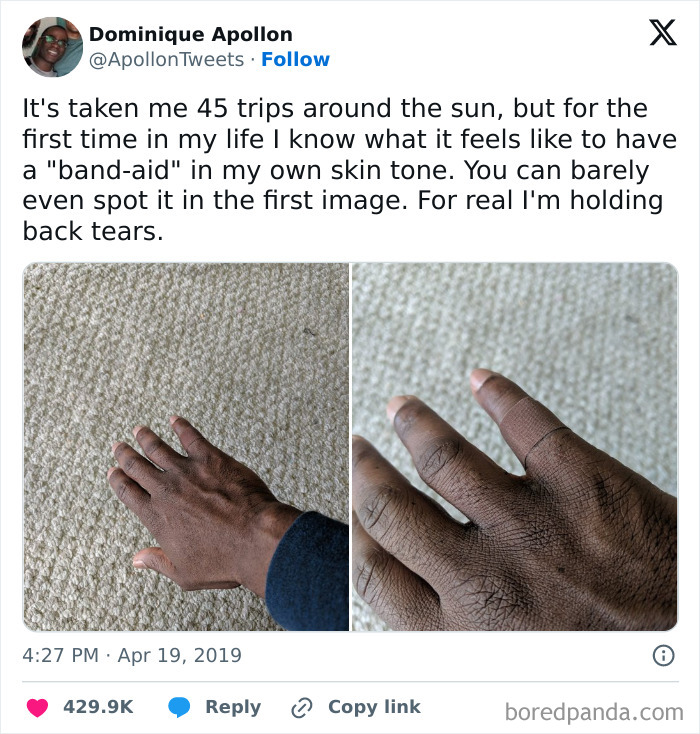 Hand with skin-tone band-aid on finger, highlighting the beauty of planet Earth's diverse skin colors and textures.