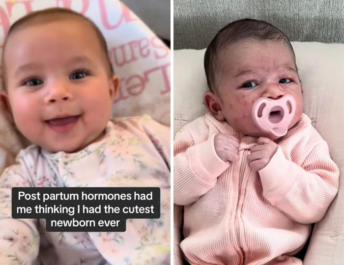 Side-by-side images of newborns illustrating the impact of postpartum hormones on mothers' perceptions of their babies.