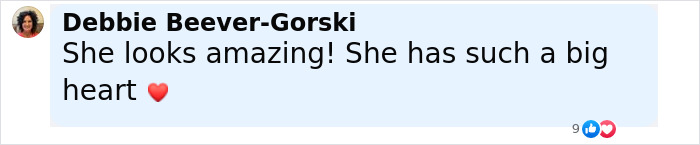 User comment praising transformation, expressing admiration for plastic surgeon who fixes botched operations, with heart emoji.
