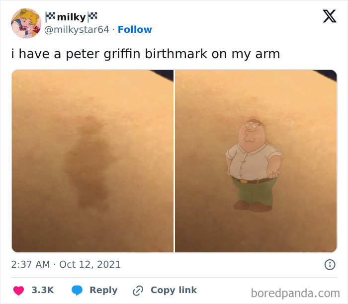 Close-up of an arm showing an interesting birthmark resembling a cartoon character from popular culture.