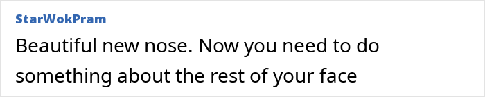 Woman sharing her experience of a $6,640 nose job that she says ruined her face due to vanity consequences