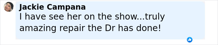 Comment by Jackie Campana praising the plastic surgeon who fixes botched operations for amazing repair work.
