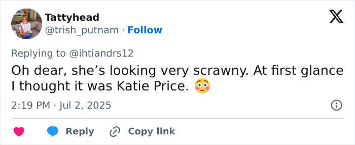 Social media reaction to Kate Beckinsale’s drastic weight loss and concerns over her scary thin appearance. Social media reaction to Kate Beckinsale’s drastic weight loss and concerns over her scary thin appearance.