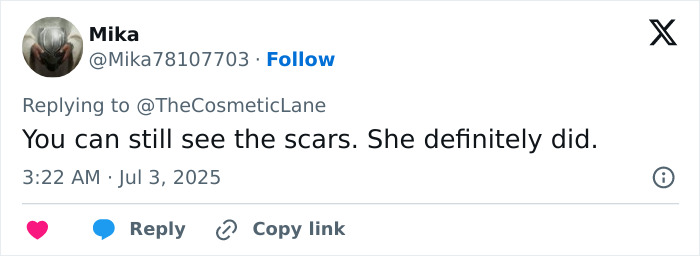 Tweet discussing Simone Biles sparking plastic surgery and retirement rumors with a new look on vacation.