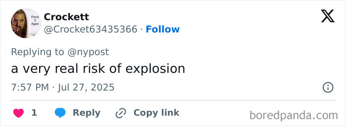 Woman with world&rsquo;s biggest lips showing before and after extreme lip enhancement surgeries.