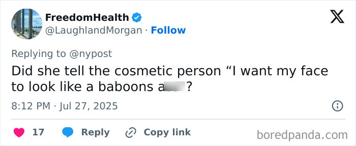 Tweet discussing woman with world&rsquo;s biggest lips and her appearance before extreme cosmetic surgeries.