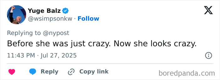 Woman with world&rsquo;s biggest lips shown before and after extreme lip enhancement surgeries, smiling in close-up portrait.