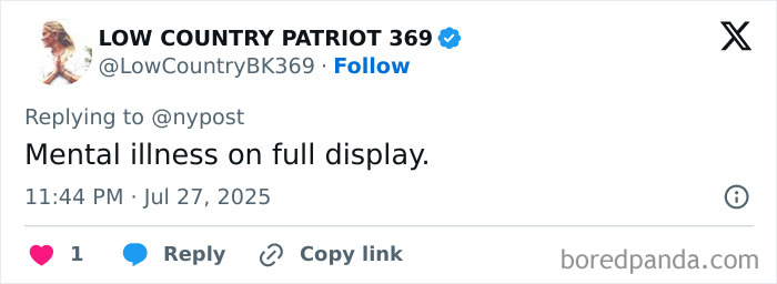 Woman with world&rsquo;s biggest lips showcasing before and after extreme lip enhancement surgeries.