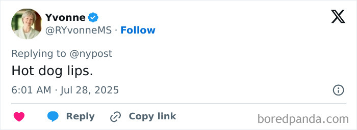 Woman with extreme lips sharing before and after photos of $26K lip surgeries in a close-up selfie.