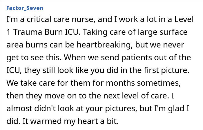 Burn survivor from gas station explosion shows remarkable transformation six years after injury and recovery process. - 12