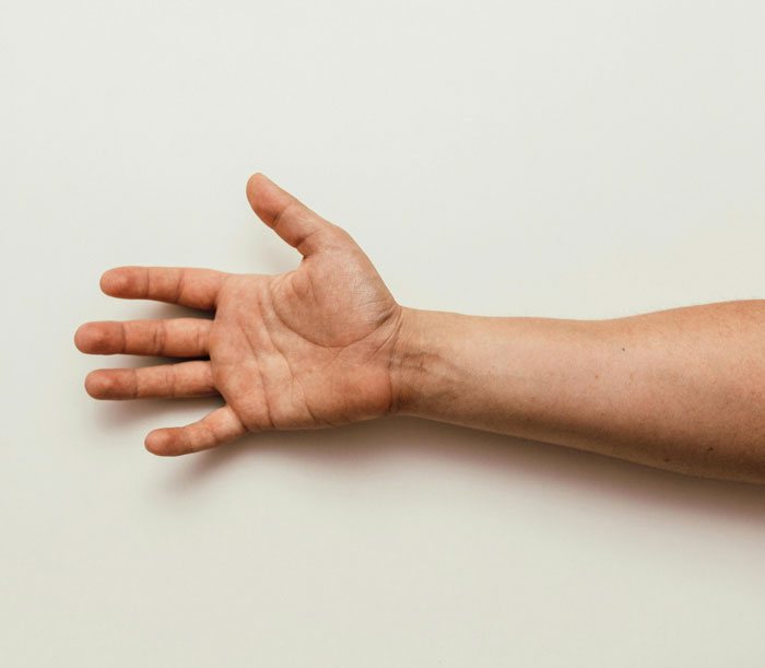Outstretched human arm and hand against a plain background illustrating mistakes made in hospitals.