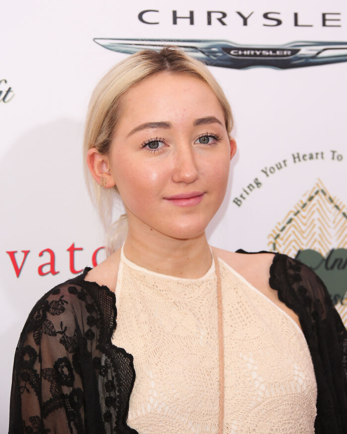 Noah Cyrus posing at event wearing a lace top and black shawl, sparking plastic surgery rumors and dramatic transformation talks. Noah Cyrus posing at event wearing a lace top and black shawl, sparking plastic surgery rumors and dramatic transformation talks.