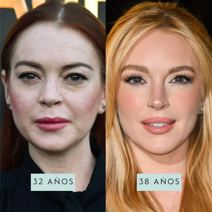 Lindsay Lohan&rsquo;s fresh-faced glow at 32 and 38, showing expert insights on plastic surgery and youthful appearance.