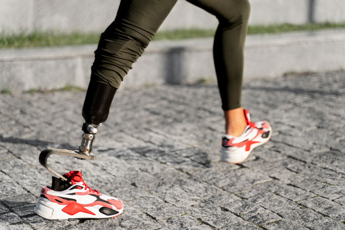Girl with prosthetic leg wearing sneakers and green pants walking on a cobblestone path, symbolizing cancer survival and strength.