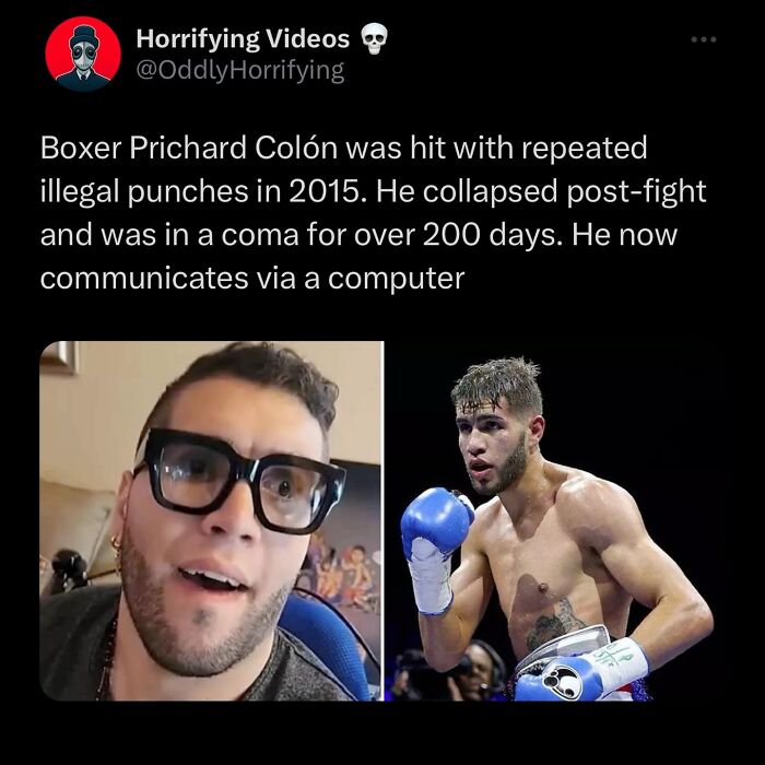 Boxer Prichard Colón, shown before and after injuries, highlights unsettling and oddly horrifying boxing consequences.