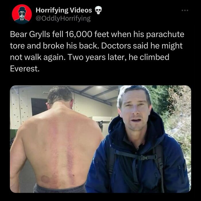 Man showing large scar on bare back next to a man in outdoor gear, representing oddly horrifying and unnerving images.