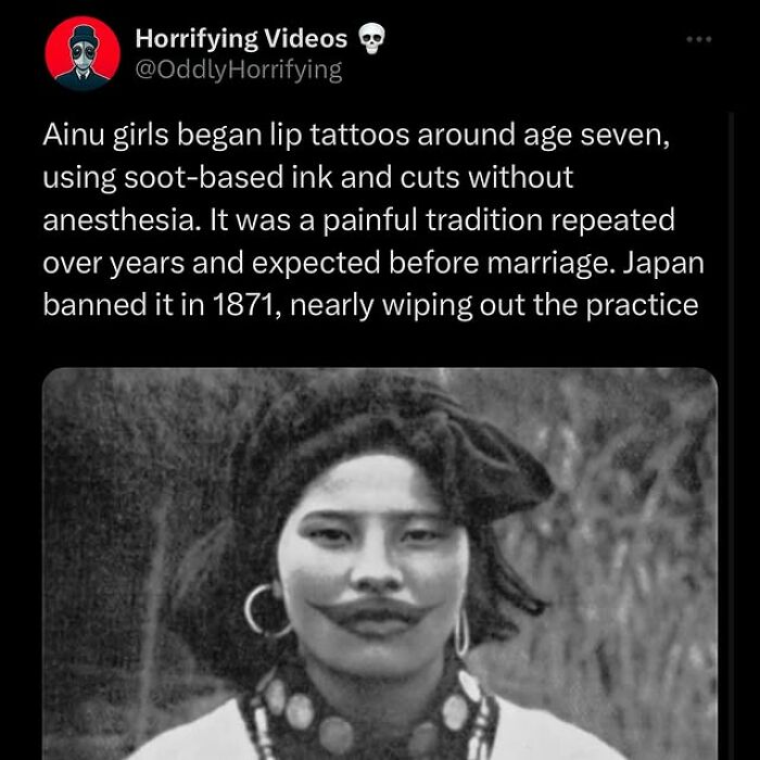 Black and white photo of an Ainu girl with traditional lip tattoos, illustrating unnerving cultural practices that may give nightmares.