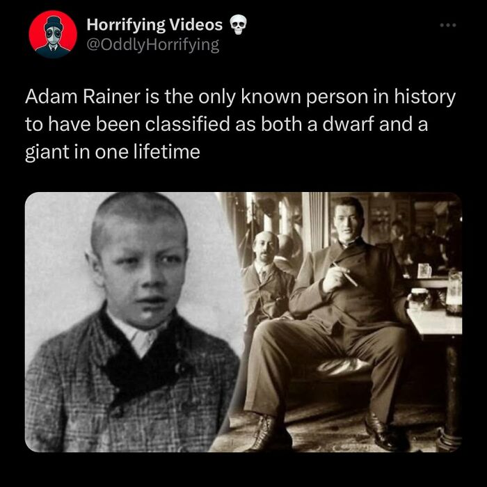 Black and white images of Adam Rainer showing his unusual growth classified as both dwarf and giant in history, odd and horrifying.