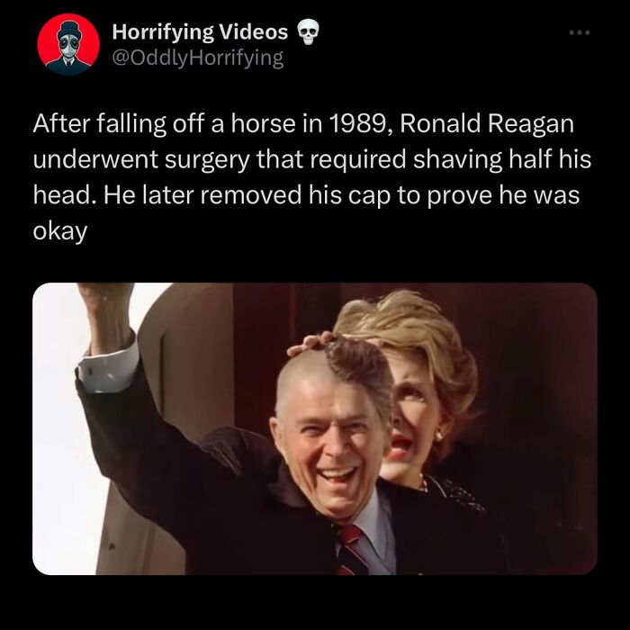 Half-shaved head photo of Ronald Reagan after surgery, illustrating odd and horrifying images that might give nightmares.