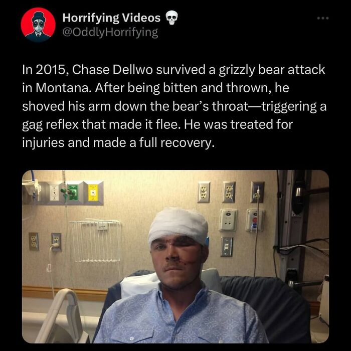 Man with head bandages and facial injuries sitting in hospital bed after surviving a grizzly bear attack, odd and horrifying image.