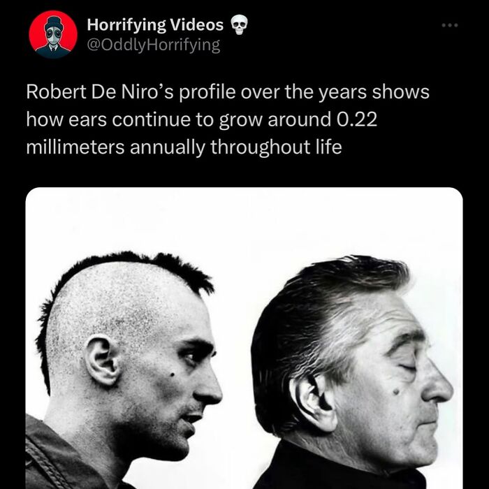 Side-by-side profile photos showing how ears grow over time in an oddly horrifying and unnerving visual comparison.