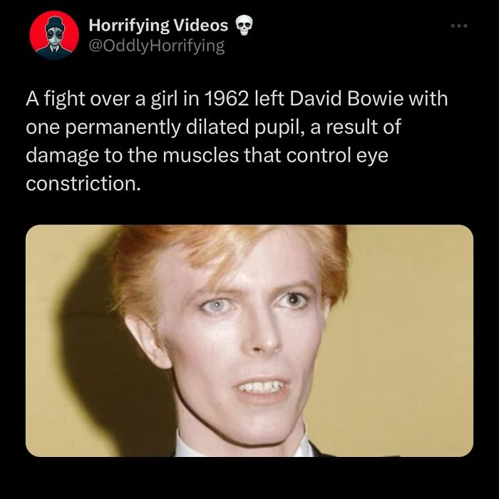 Text post explaining David Bowie’s permanently dilated pupil from an eye muscle injury, related to unnerving images.