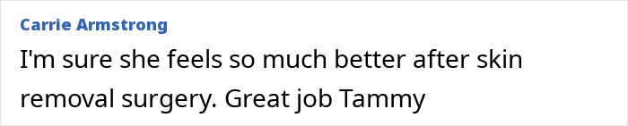 Comment praising Tammy Slaton from 1000-Lb. Sisters, mentioning she feels better after skin removal surgery. - 7
