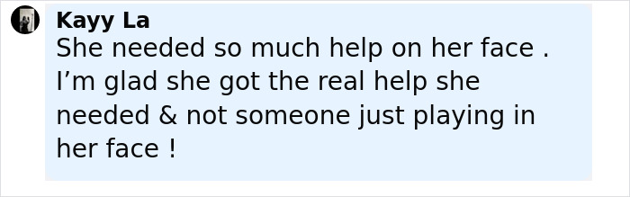 Comment from Kayy La praising a plastic surgeon who fixes botched operations and provides real facial help.