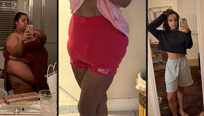 Before and after plastic surgery transformation showing dramatic body contour changes from everyday to polished look.