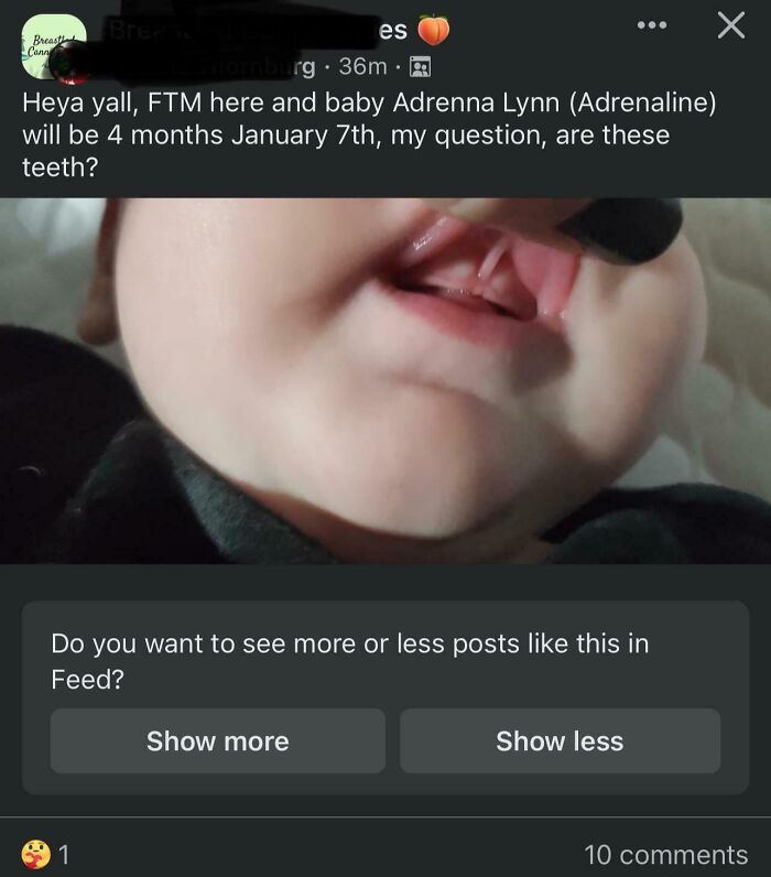 Close-up of a baby's mouth showing emerging teeth, related to unique baby names parents loved but others judged.