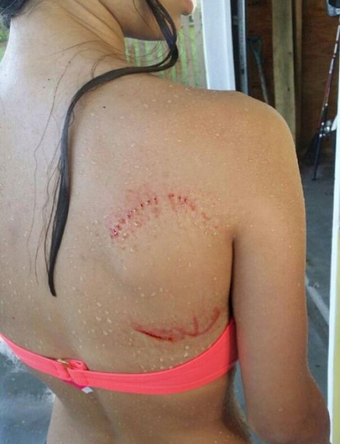 Close-up of a person’s back showing unusual skin marks and water droplets, illustrating unbelievable luck moments.