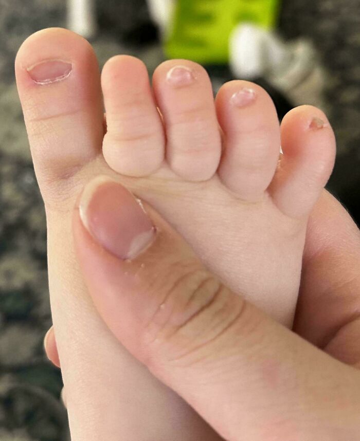 Close up of an adult thumb next to a baby’s tiny toes, showing a mildly interesting size contrast to share.