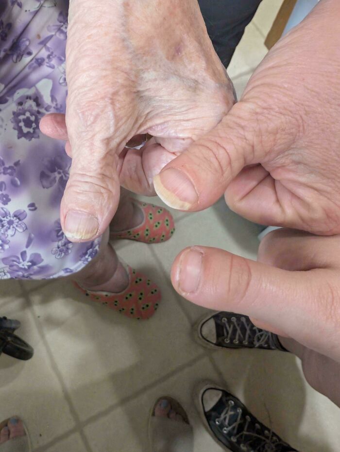 Two hands with closely matching thumbs held together, showing a mildly interesting comparison of nails.