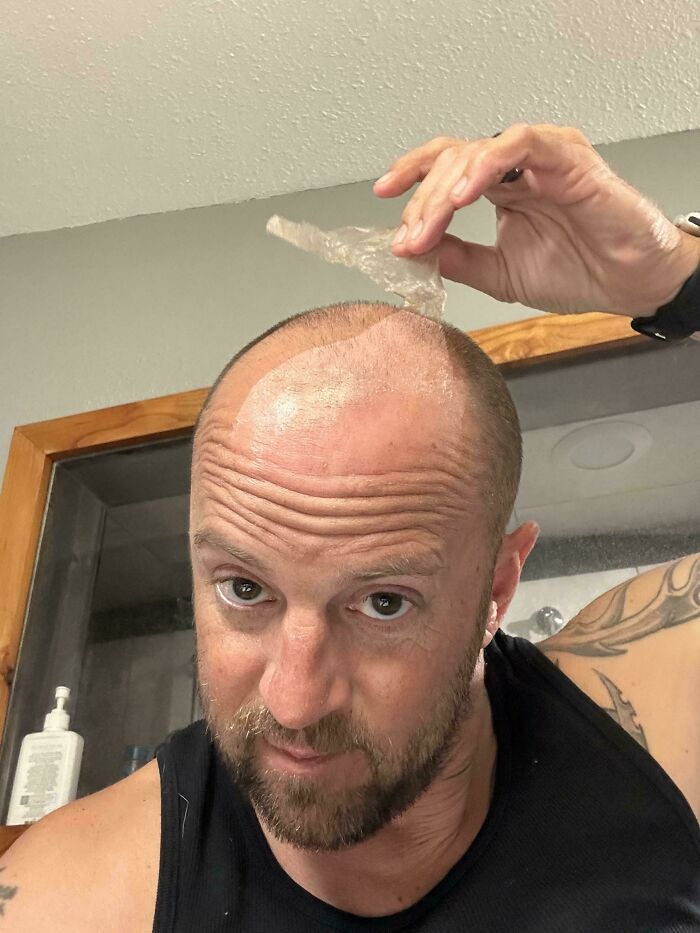 Man in black tank top peeling something transparent from his bald head, a mildly interesting moment shared by people online.