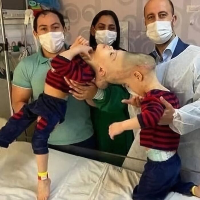 Three masked adults holding and supporting a child with a rare condition in a hospital, showcasing amazing wholesome care.