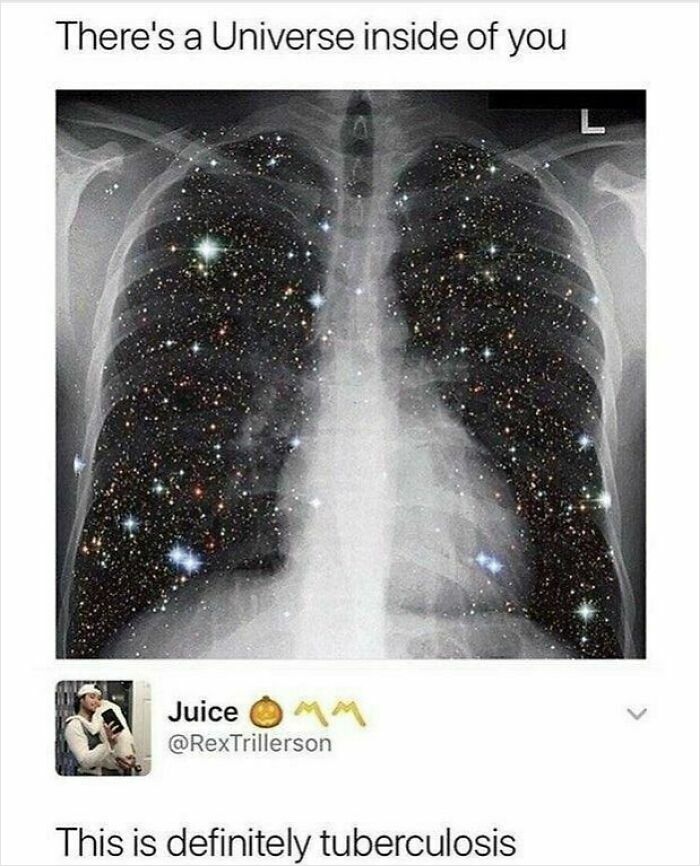 X-ray image edited with stars inside lungs, humorous medical meme referencing healthcare and tuberculosis laughter.