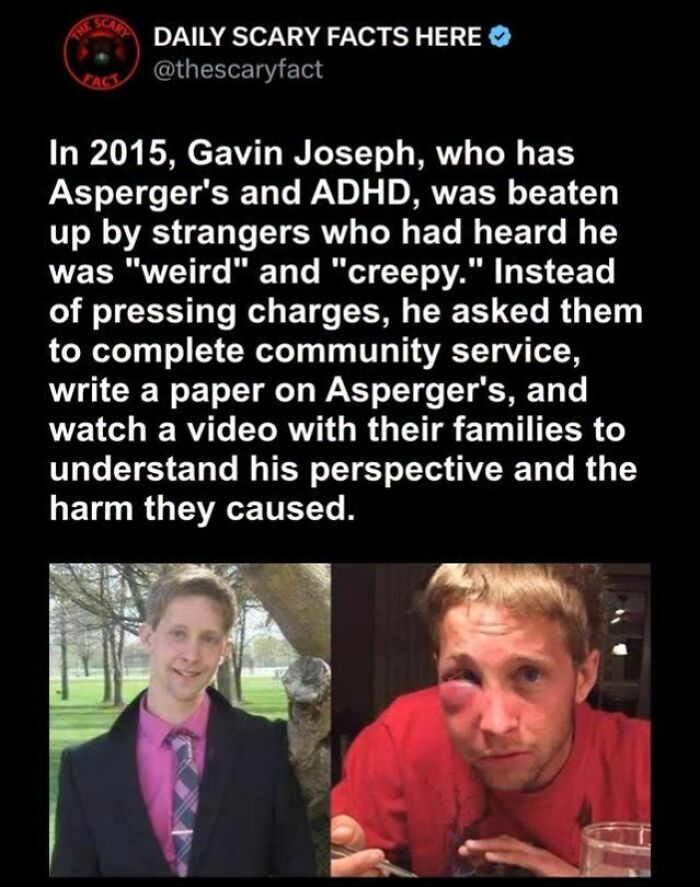 Before and after photos of a man who was attacked, illustrating a scary fact about understanding and harm caused.