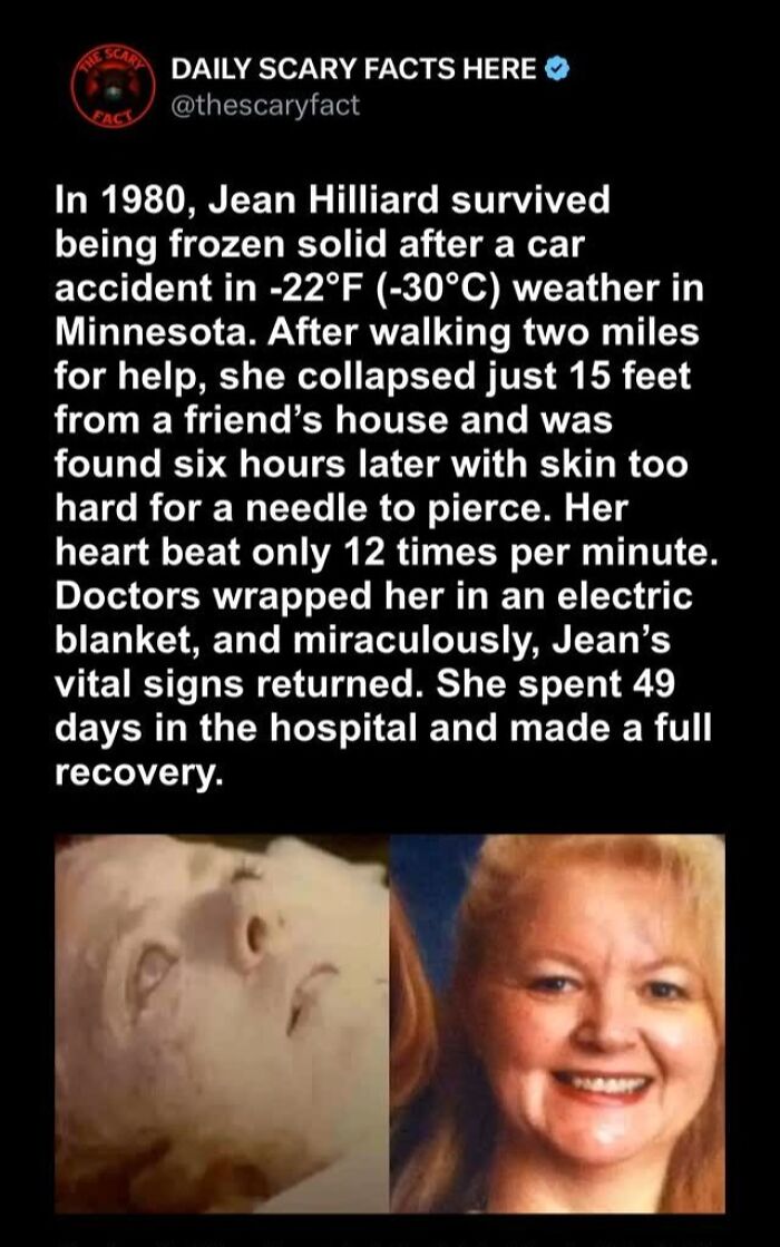 Survivor frozen solid in extreme cold shares scary facts about miraculous recovery and resilience in harsh weather conditions.