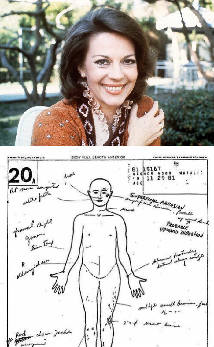 Smiling woman outdoors paired with a forensic body diagram showing notes on superficial abrasion in a mystery case.