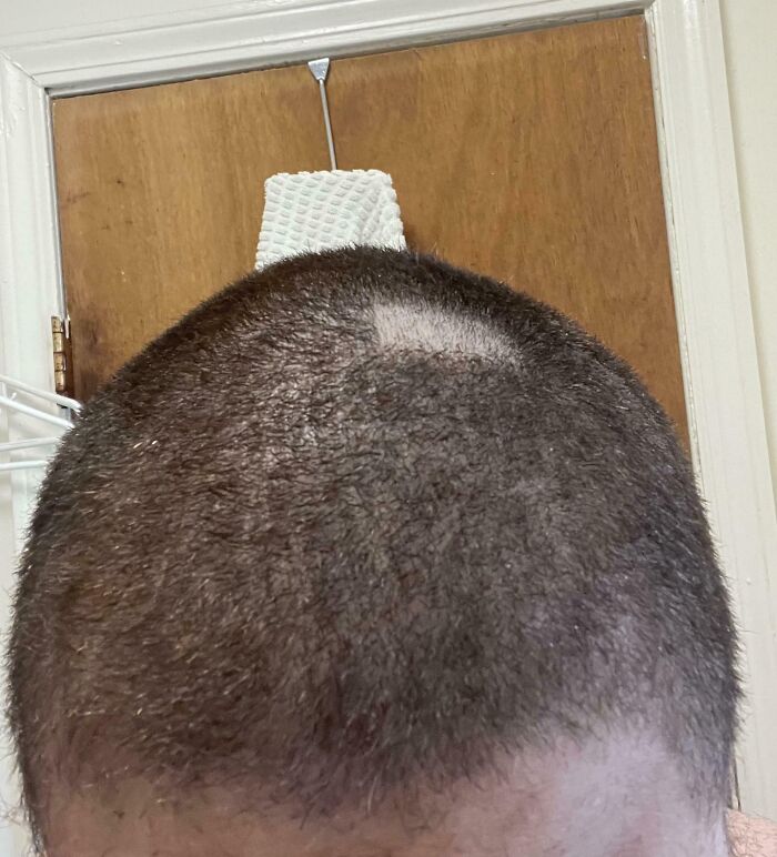 Close-up of a person's head with an uneven buzz cut showing a funny unfortunate situation from forgetting something.