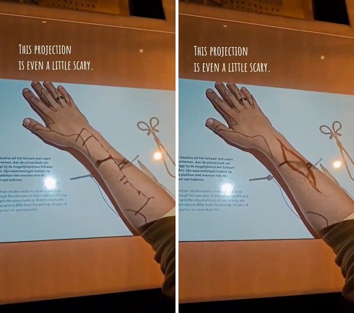 Projection of medical veins and arteries mapped on a person's arm, illustrating anatomy with scissors in background.