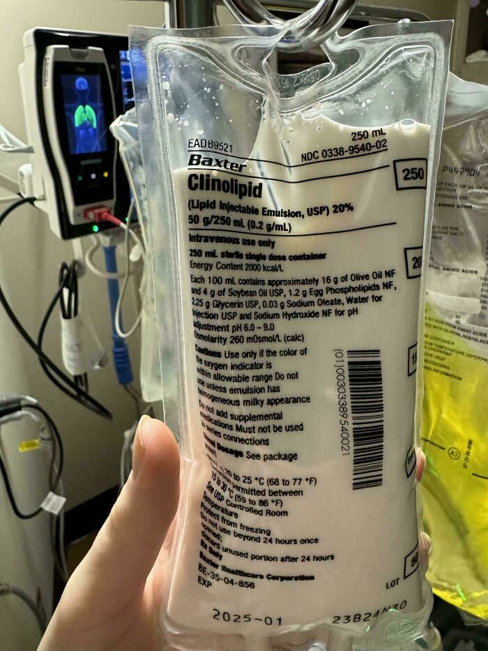 Medical intravenous lipid emulsion bag held in hand, illustrating fascinating and deeply disturbing medical photos theme.