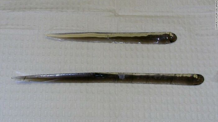 Two elongated foreign objects removed from the body, shown on a medical surface in a medical photos collection.