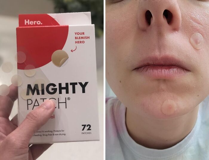 Mighty Patch acne patches shown in packaging and applied on face as popular Amazon skincare find.